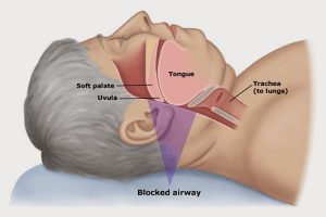 Animal Husbandry And Veterinary Sciences Notes On - Treatment Of Asphyxia - For W.B.C.S. Examination