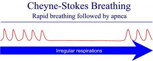 W.B.C.S.-Examination-Notes-On-Cheyne-Stokes-Breathing-Animal-Husbandry-And-Veterinary-Sciences-Notes